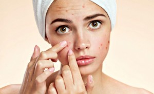 acne bestrijden voeding